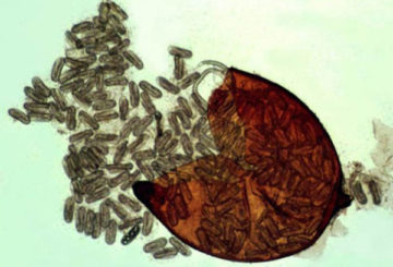 Verpletterde nematodencyste onder een microscoop