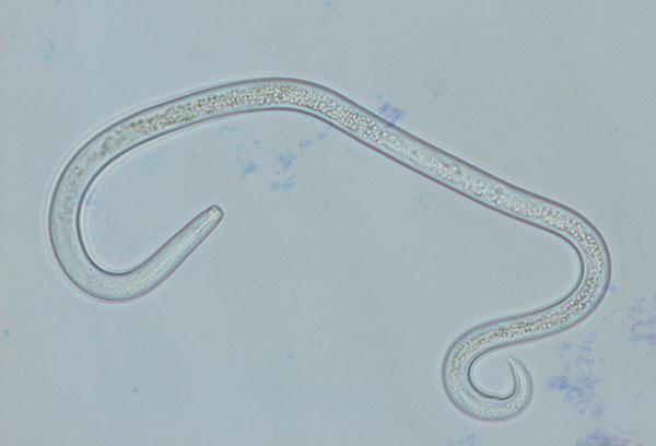 Nematoda under the microscope
