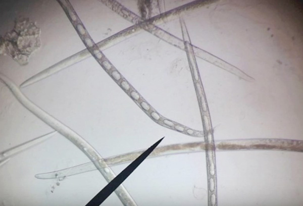 Nematoder under ett mikroskop