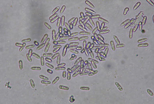 Houba Colletotrichum orbiculare