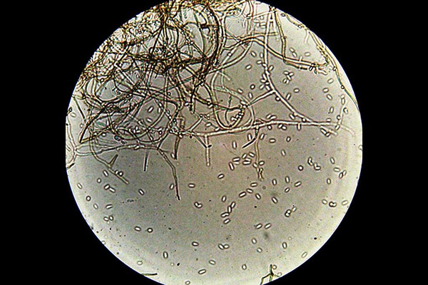 L'agent causal de l'anthracnose